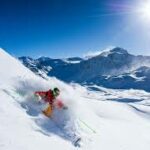 Mini-vis en orthodontie - Val d'Isère 12/25 (92)